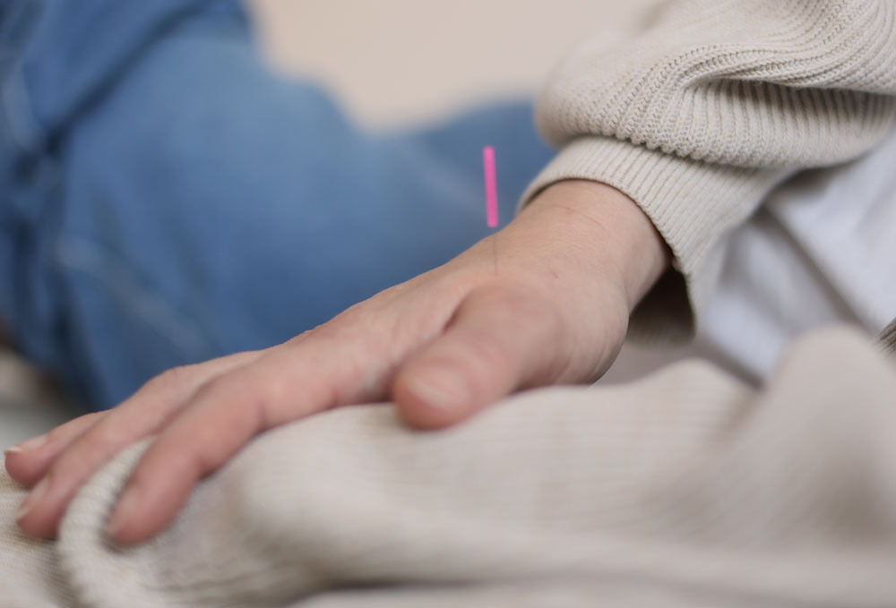 Akupunktur Schwangerchaft Hand